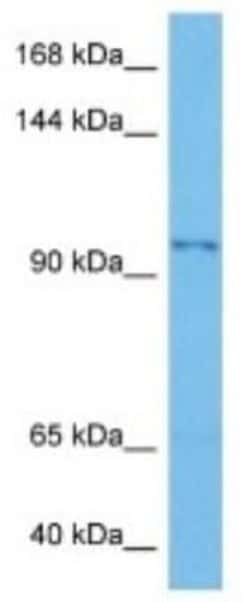 SART2 Rabbit anti-Human, Polyclonal, Novus Biologicals:Antibodies:Primary